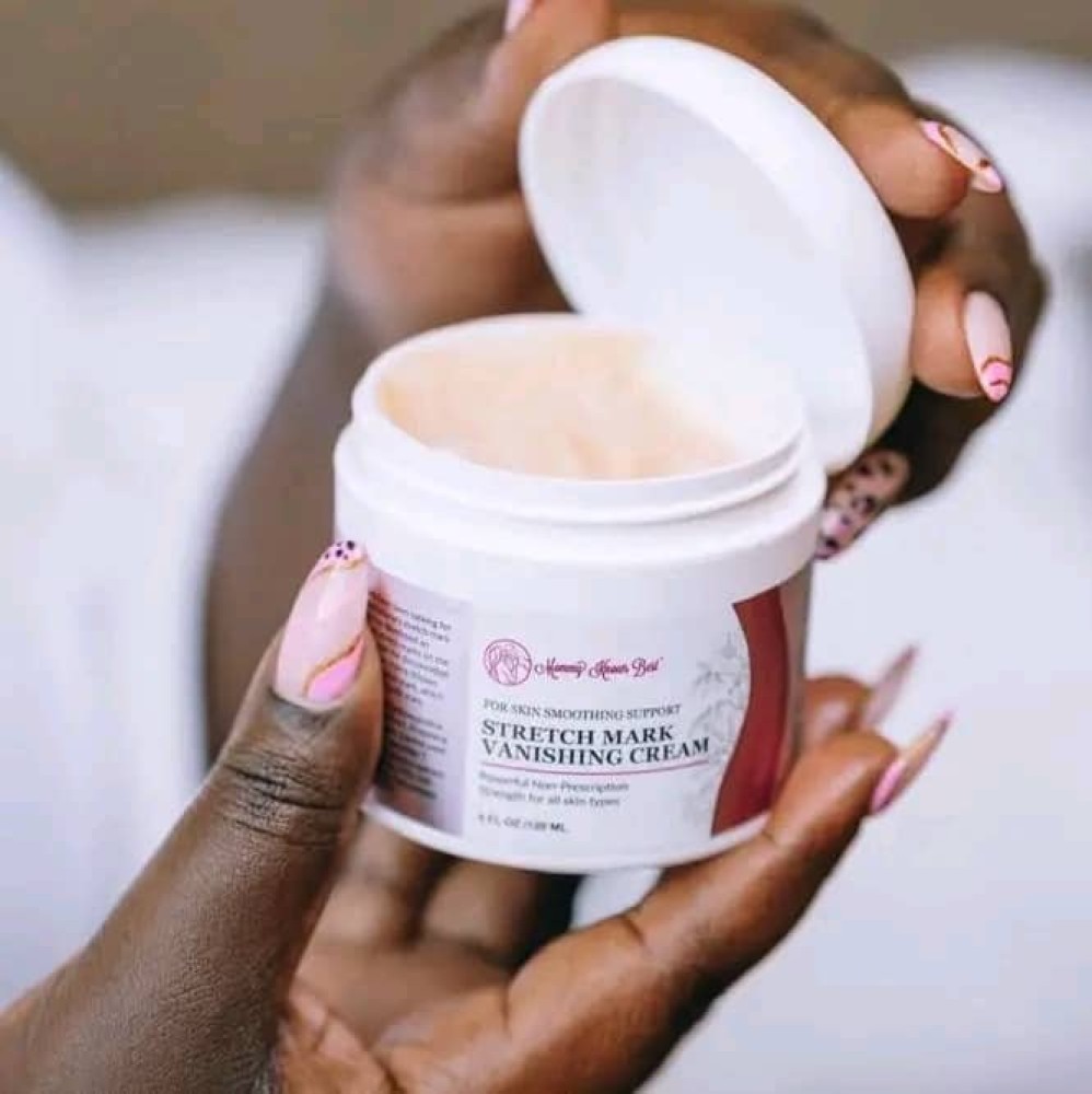 Stretch marks vanishing cream